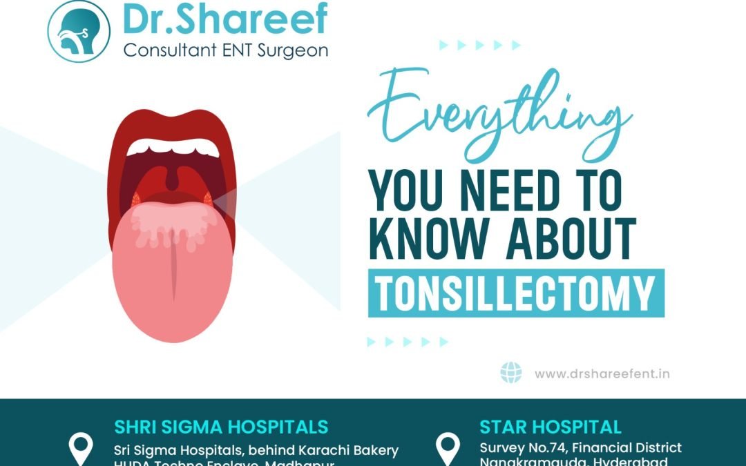 Everything You Need to Know About Tonsillectomy