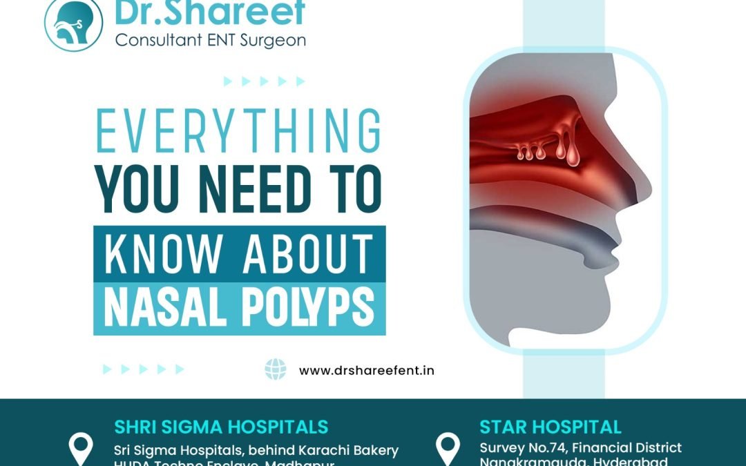 Everything You Need to Know About Nasal Polyps
