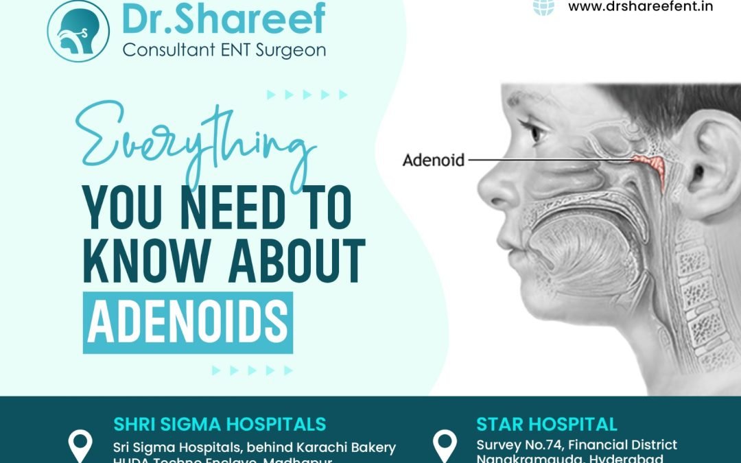 Everything You Need to Know About Adenoids